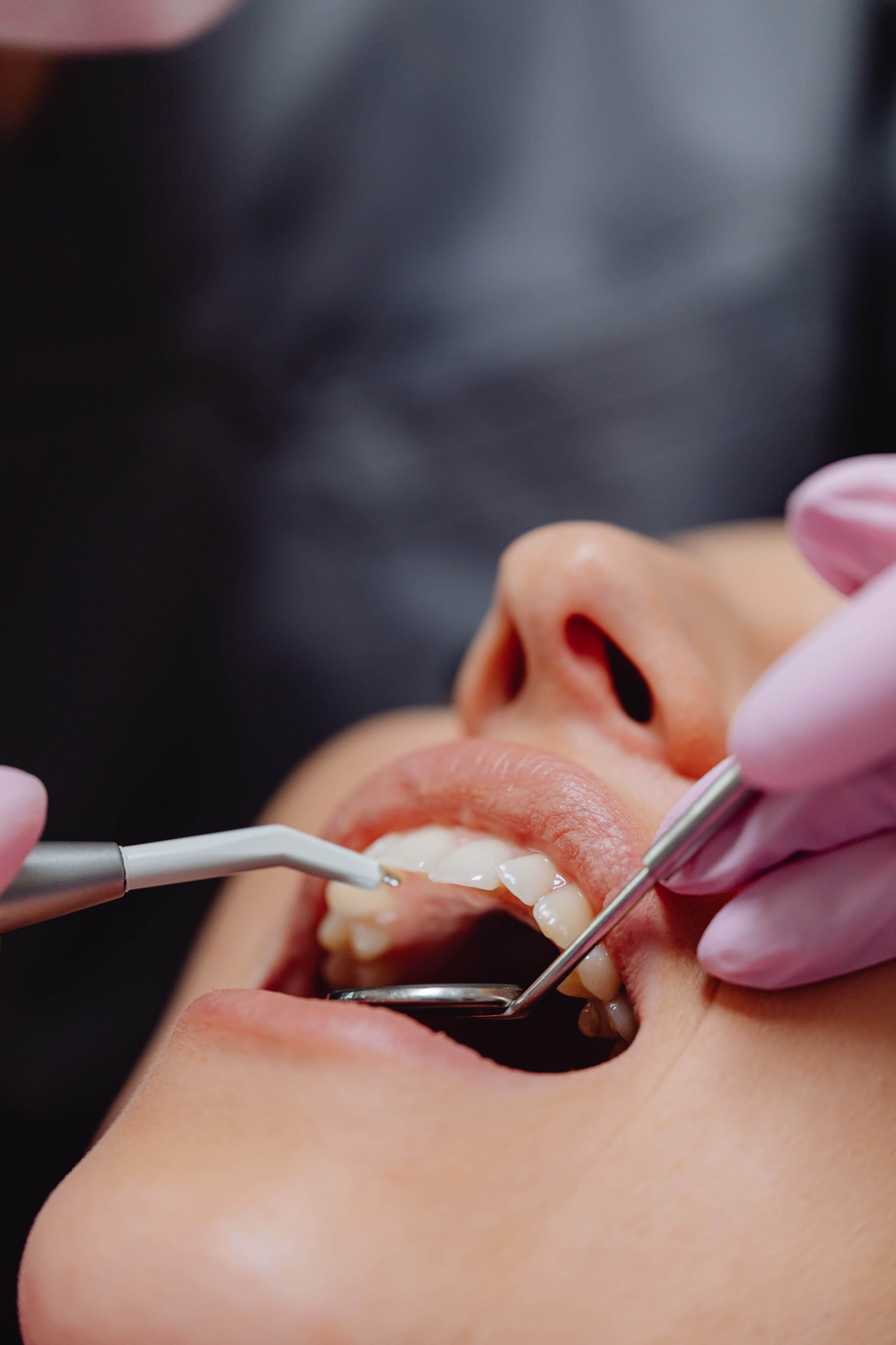 Endodoncia